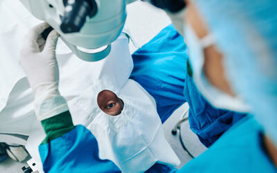 Posterior Polar Cataracts: What You Need to Know About Surgery Risks and Outcomes