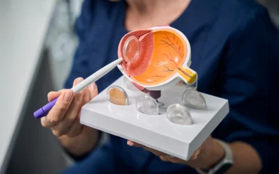 YAG Laser Capsulotomy: A Guide to Treating Secondary Cataracts