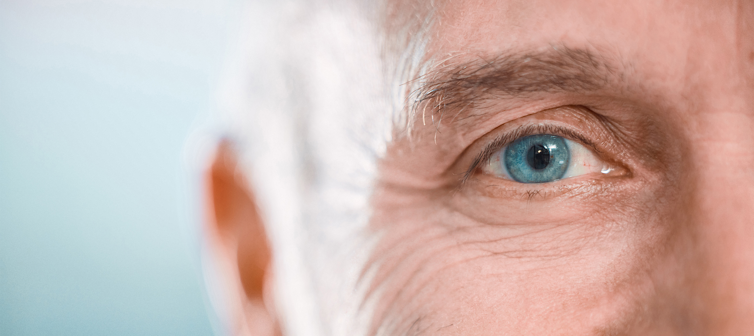 coverfold-nuclear-sclerotic-cataracts Nuclear Sclerotic Cataracts