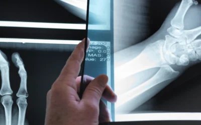 How Radiation Exposure Increases the Risk of Cataract Formation