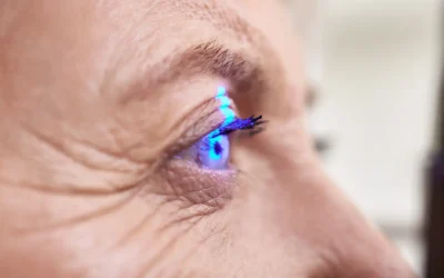 What Is the Success Rate of YAG Laser Capsulotomy?