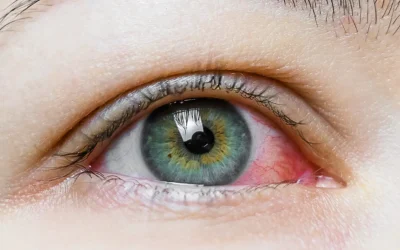 Cataract Surgery in Uveitic Eyes: A Review of Outcomes and Risk Mitigation