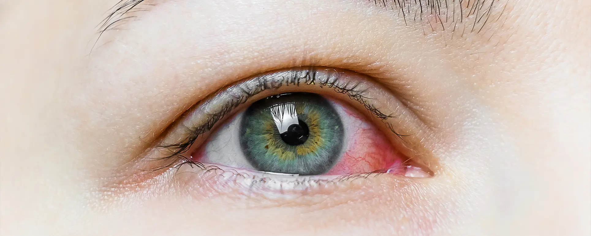 Cover Red eye 1