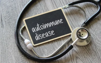 Cataract Surgery Outcomes in Patients with Autoimmune Disease: What Does the Research Say?