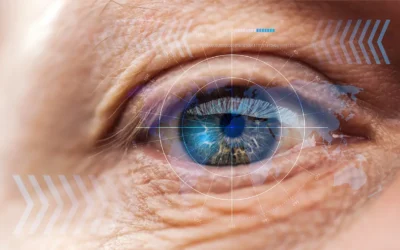 Does Pupil Size Matter in Cataract Surgery Planning? A Review of Current Evidence