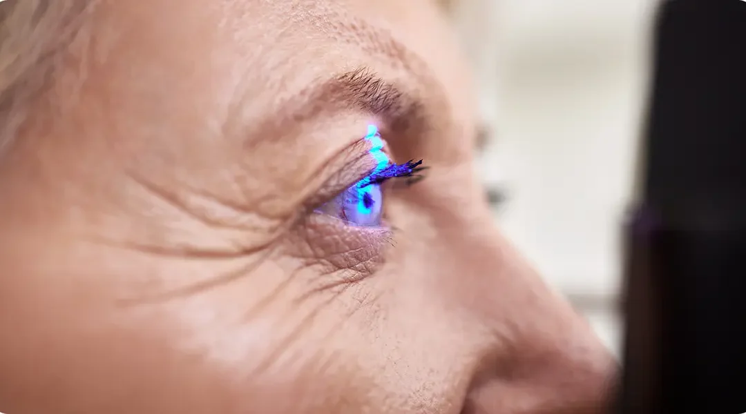 Cataract Surgery and Persistent Floaters: What You Need to Know