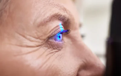 Cataract Surgery and Persistent Floaters: What You Need to Know