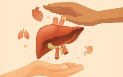 Had an Organ Transplant? Here’s What You Need to Know Before Cataract Surgery