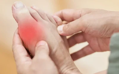 Cataract Surgery in Patients with Gout: Medication Timing and Uric Acid Considerations
