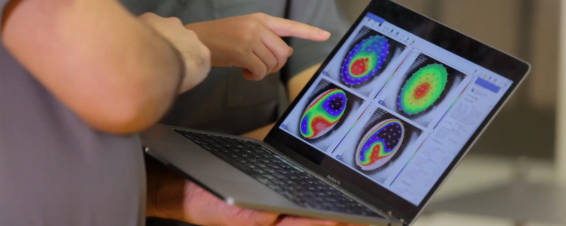 Technologic Thermage Consultation 1