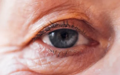 Hypoxia and the Ageing Lens: How Oxygen Levels Affect Cataract Risk