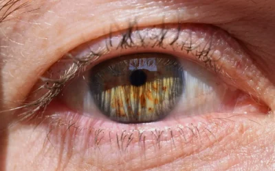 The Impact of Pupil Size on Choosing an IOL