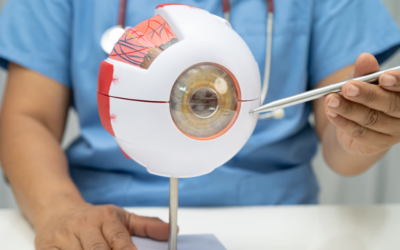 Angle Kappa and Lens Surgery: Does It Affect Premium Lens Choice?