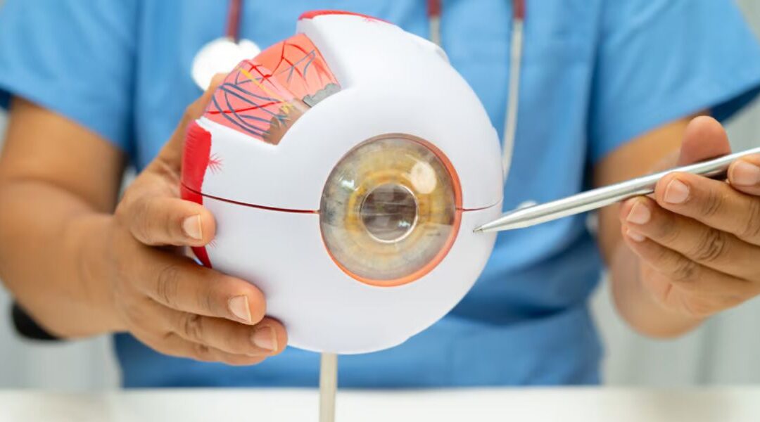 Can RLE Correct Astigmatism?