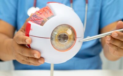 Can RLE Correct Astigmatism?