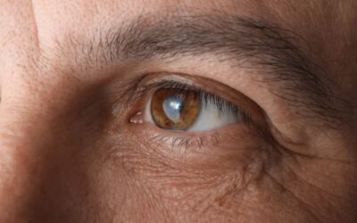 Can ICL Surgery Correct Very High Prescriptions?