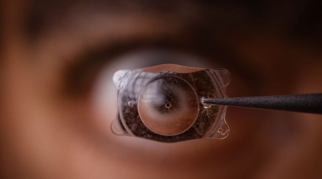 What Is EVO ICL and How Is It Different From Earlier ICL Lenses?