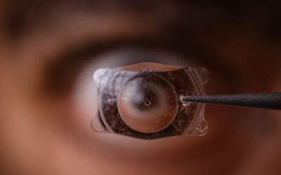 What Is EVO ICL and How Is It Different From Earlier ICL Lenses?