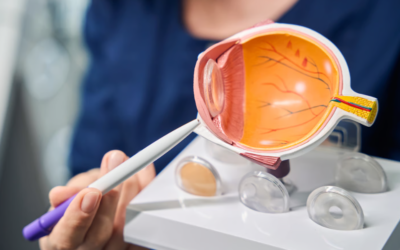 Is Refractive Lens Exchange a One-Time Decision for Life?