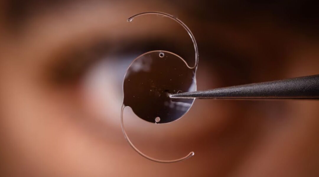 How Do Surgeons Choose the Right Lens for Lens Surgery?