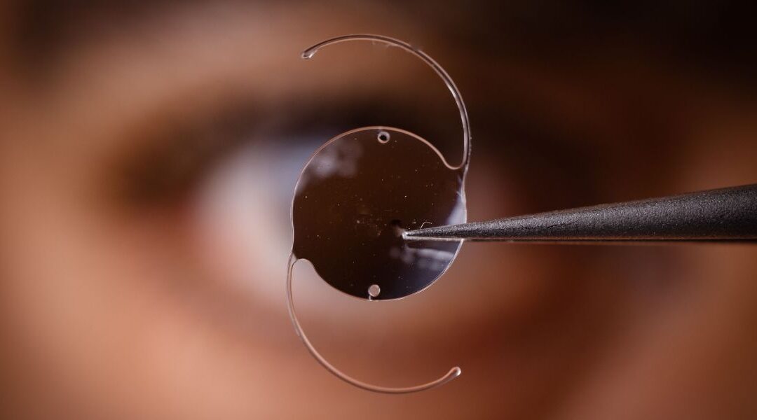 Is Lens Replacement Surgery Worth It? Pros and Cons Explained