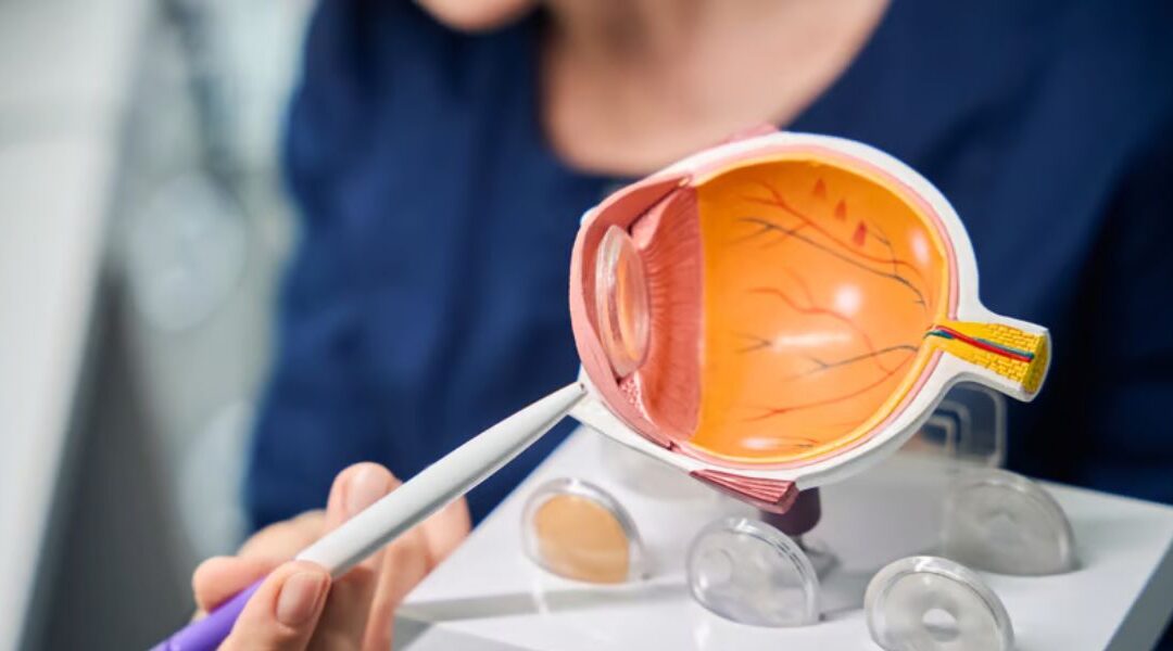 How Do Surgeons Choose the Right ICL Lens Type?