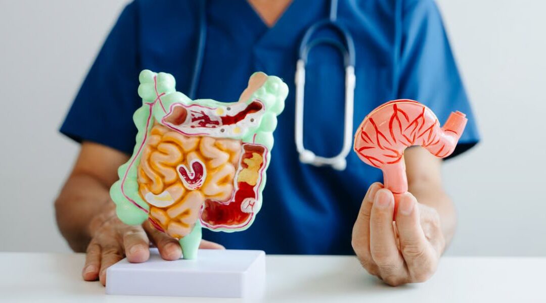 RLE Surgery and Ulcerative Colitis: What to Know