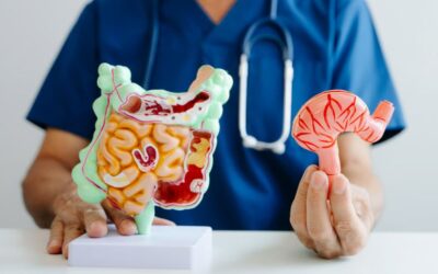 RLE Surgery and Ulcerative Colitis: What to Know