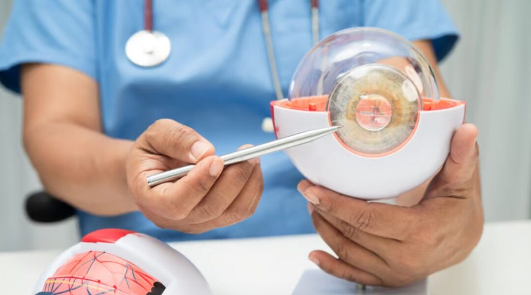 How Do Surgeons Choose the Right Lens for Lens Replacement Surgery?