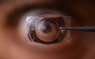 ICL Surgery and Chemotherapy: What Patients Should Know