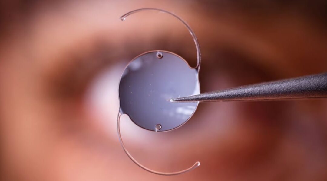 Can You Have ICL Surgery If You Have Recently Had Major Surgery?