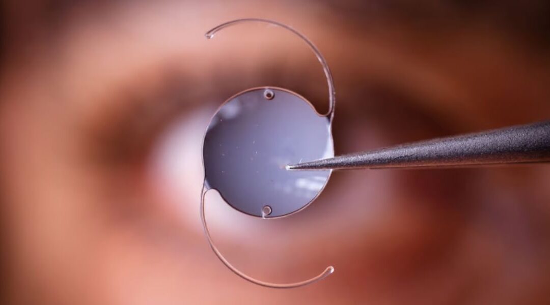 What Happens If You Blink During RLE Surgery?