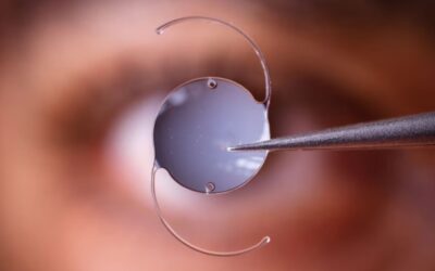 What Happens If You Blink During RLE Surgery?